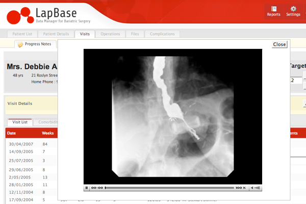 Lapbase Patient Record